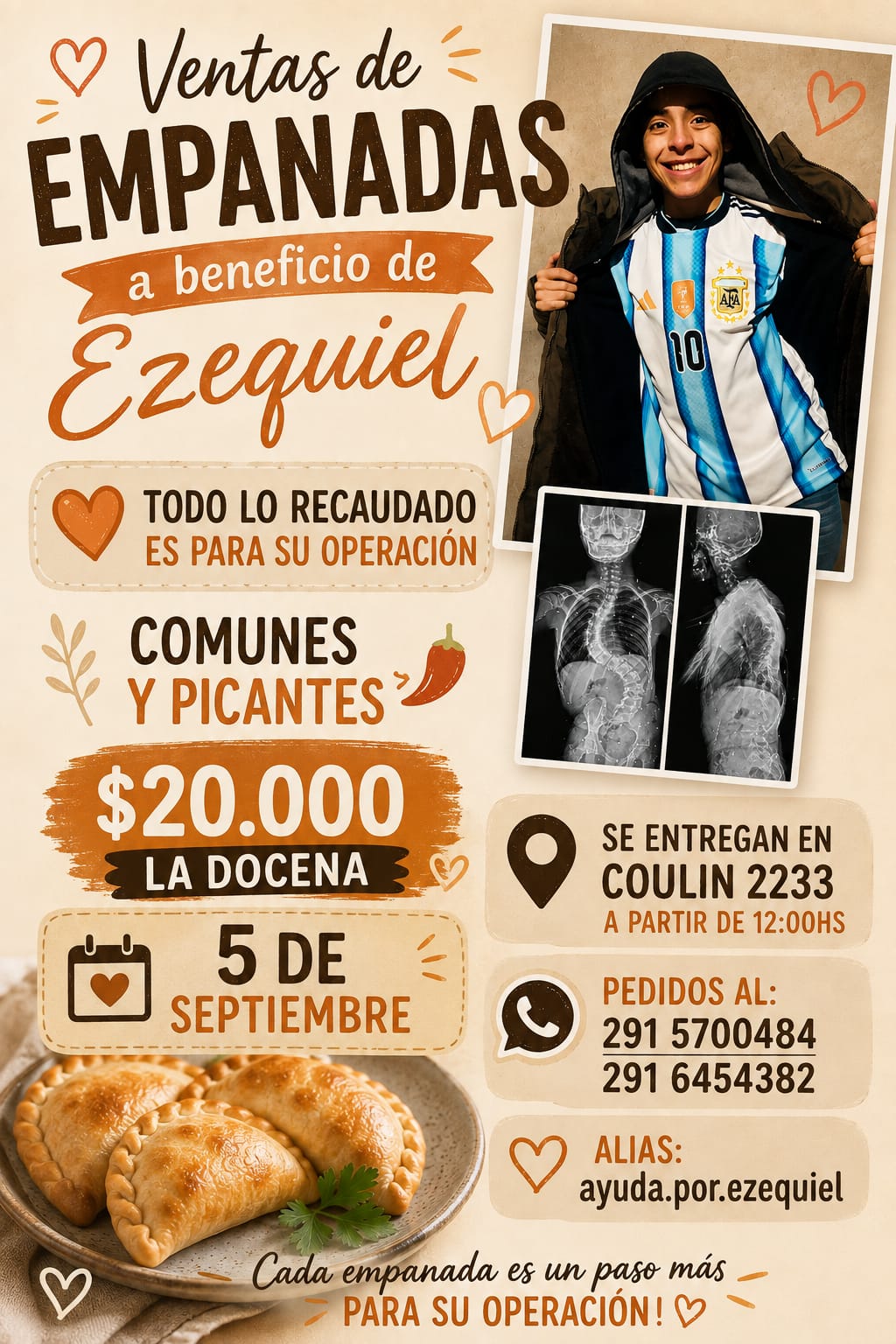 Venta de empanadas a beneficio de Ezequiel para que pueda operarse y mejorar su calidad de vida